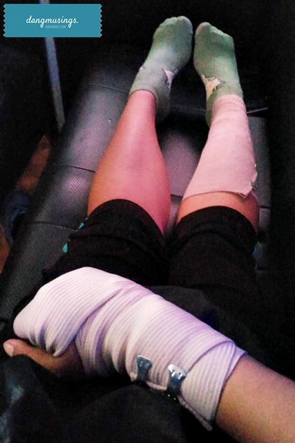 injured on my birthday :'(